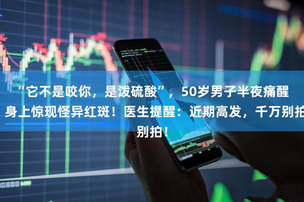 “它不是咬你，是泼硫酸”，50岁男子半夜痛醒，身上惊现怪异红斑！医生提醒：近期高发，千万别拍！